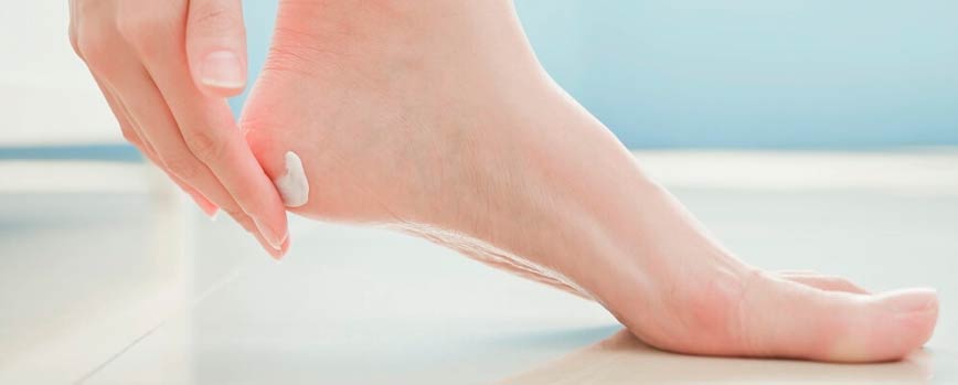 ¿Cómo prevenir la dishidrosis en los pies?
