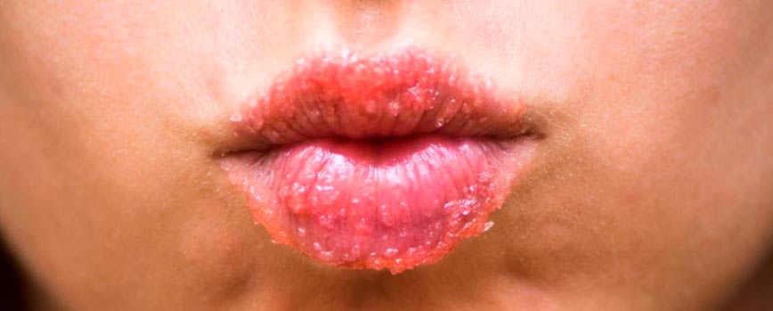 ¿Cómo exfoliar los labios en casa?