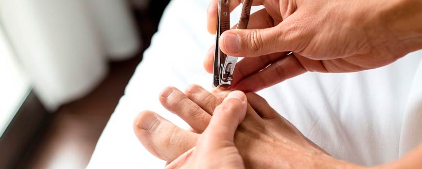 ¿Cómo curar un uñero correctamente en casa?