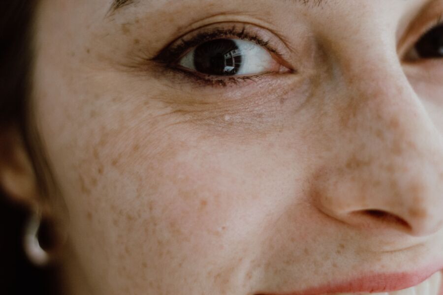 Un retrato íntimo en primer plano que captura las pecas detalladas y los ojos vibrantes de una mujer en Estambul.