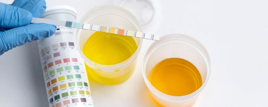 Médico de laboratorio que realiza un examen médico de orina