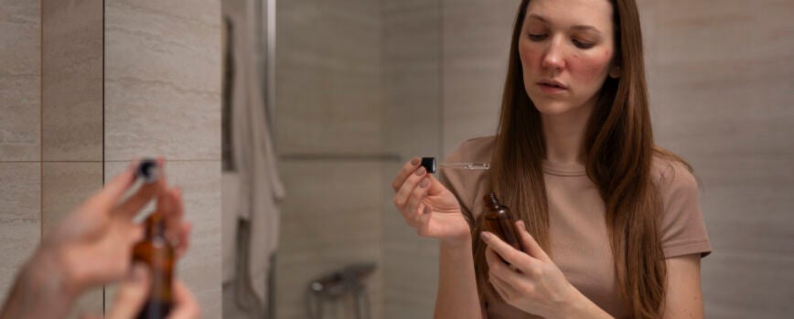 Mujer lidiando con rosácea usando suero para la piel