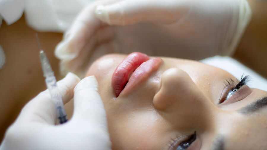 Primer plano de una mujer que recibe un aumento de labios con una jeringa por parte de un profesional.