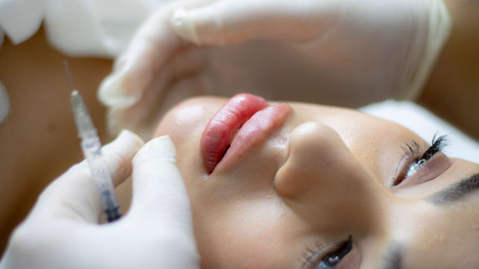 Primer plano de una mujer que recibe un aumento de labios con una jeringa por parte de un profesional.