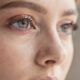 ojos irritados por