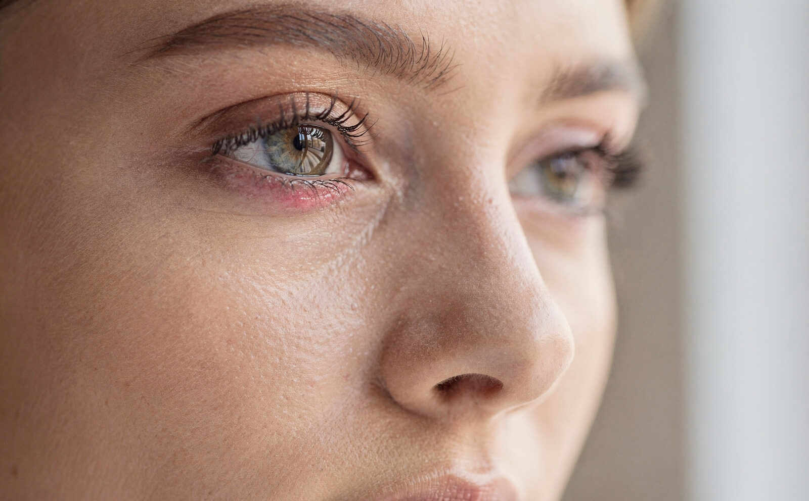 ojos irritados por