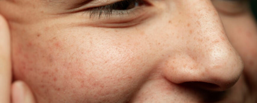 Cerca de la textura de la piel del joven sonriente