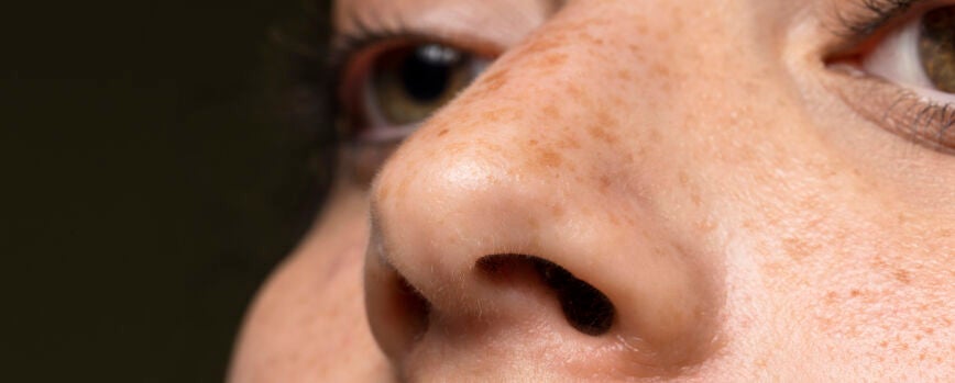 Mujer de cerca con pecas