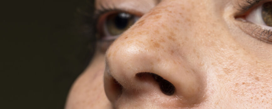 Mujer de cerca con pecas