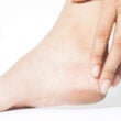 Mujer, agrietado, talones, blanco, Plano de fondo, pie, sano, concepto