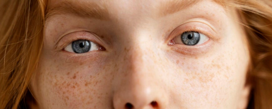 Cerrar hermosa mujer con pecas