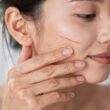 Mujer se aplica aceite cosmética en cicatriz sutil