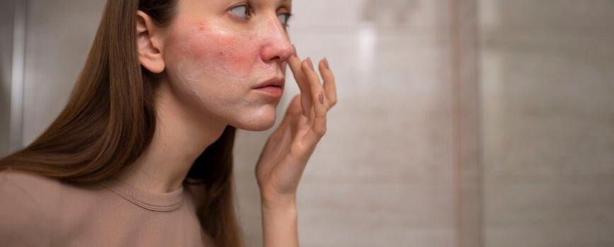 Mujer mirando su rosácea en el espejo