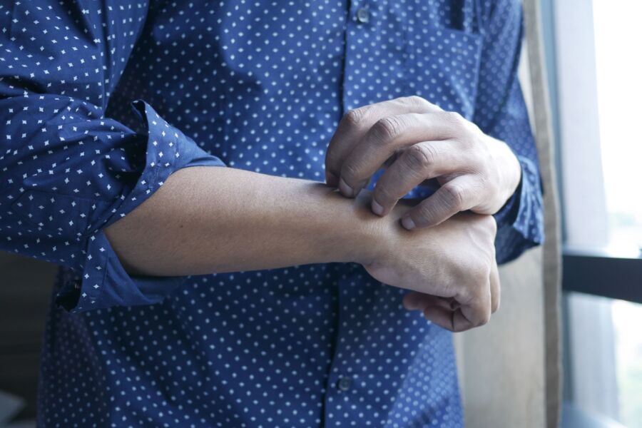 Un hombre con una camisa de lunares rascándose el brazo junto a una ventana, simbolizando incomodidad o irritación.