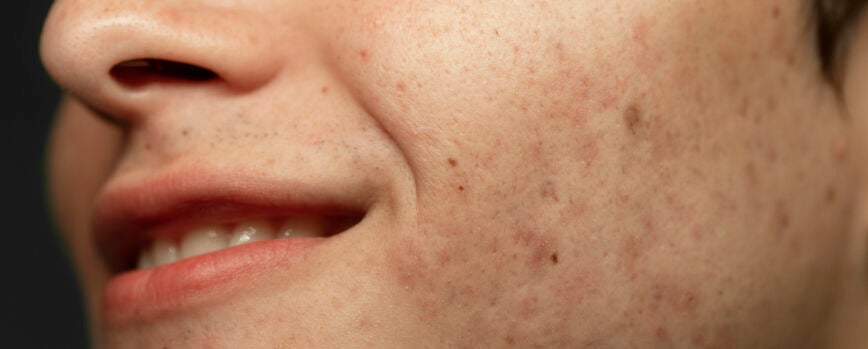 Textura de la piel del hombre sonriente de vista lateral